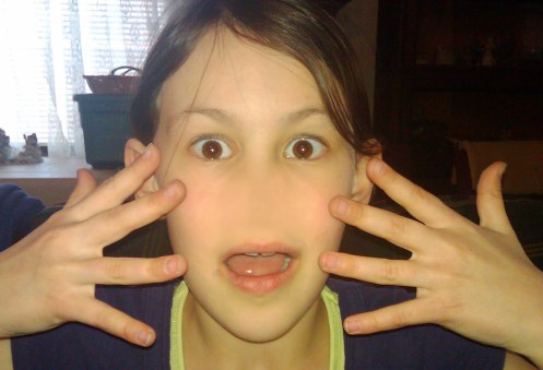 Nose Snatcher Katie's nose has been snatched!